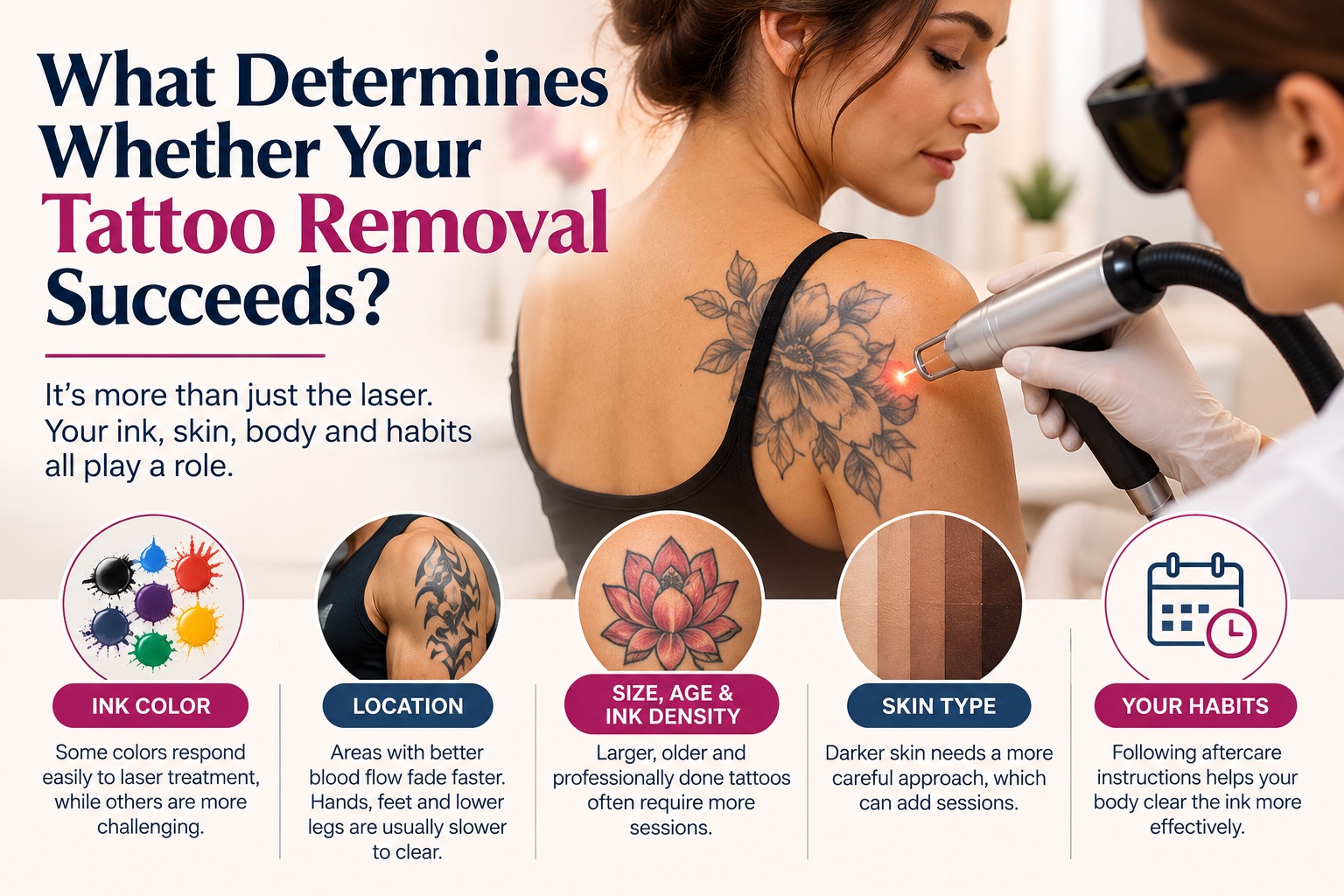 What Determines Tattoo Removal Success? 
